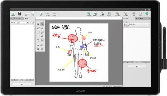 Графический дисплей Wacom DTH-2452